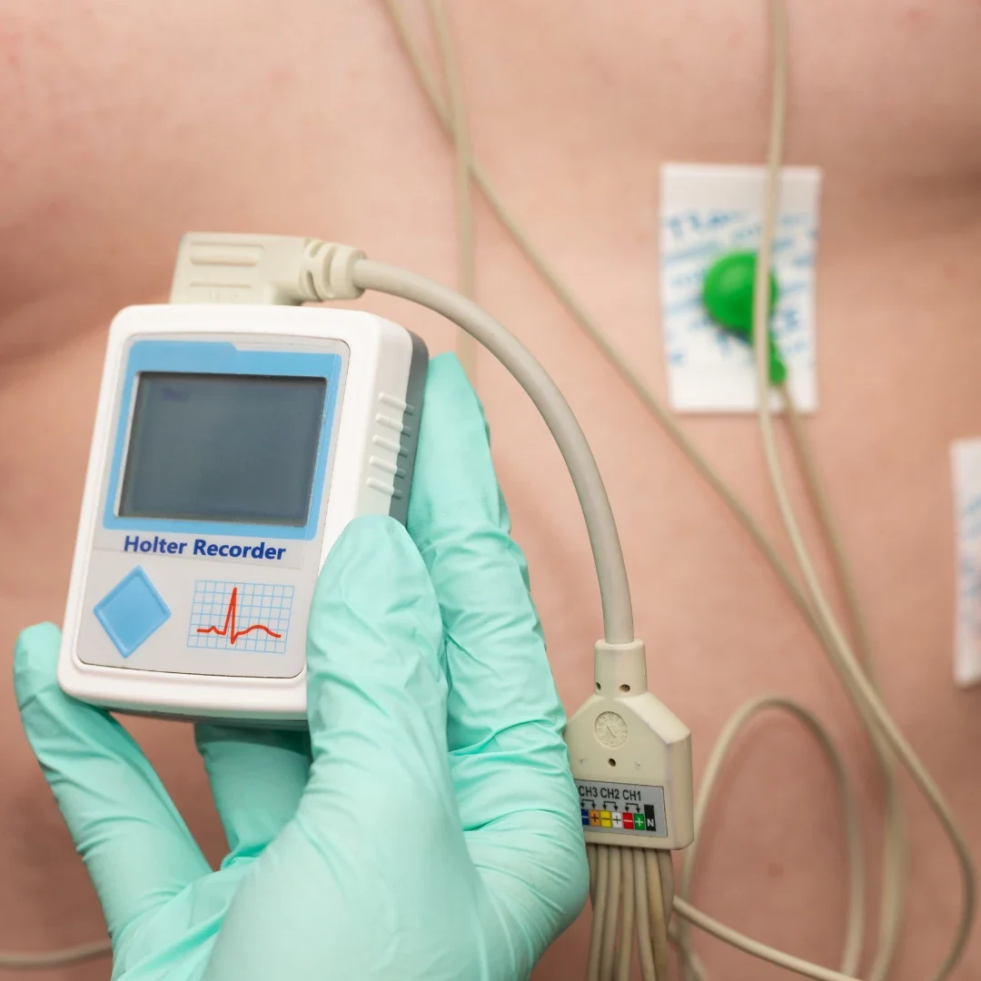 Exame de Holter (monitoramento cardíaco 24h) na Clínica Centrocor