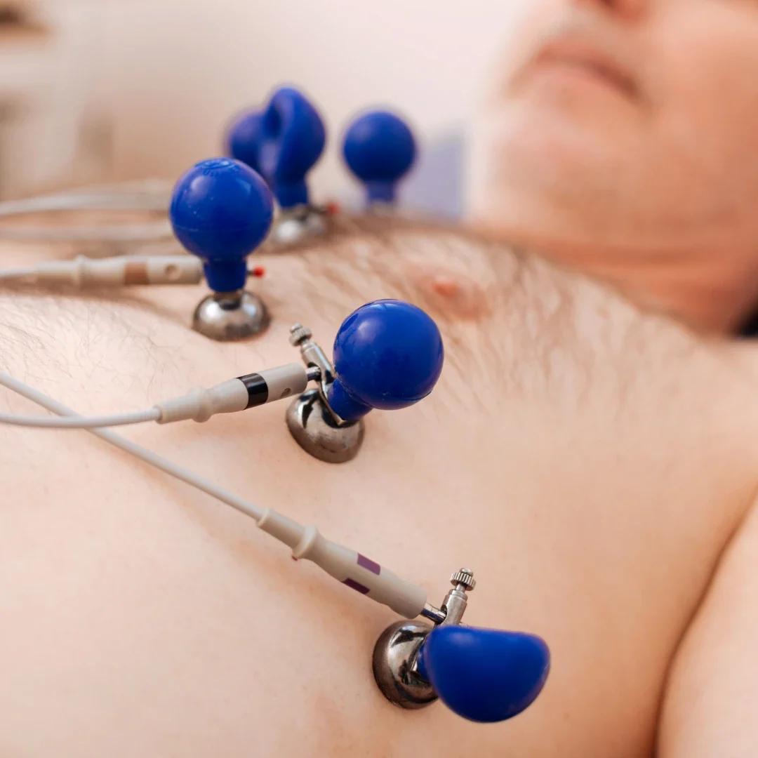 Exame de eletrocardiograma na Clínica Centrocor